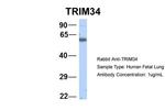 TRIM34 Antibody in Western Blot (WB)