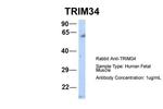 TRIM34 Antibody in Western Blot (WB)