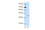 HMBOX1 Polyclonal Antibody