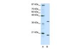 ZNF322A Antibody in Western Blot (WB)