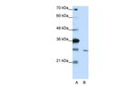 ZNF397 Antibody in Western Blot (WB)