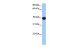 SSBP4 Polyclonal Antibody