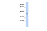 CPXCR1 Antibody in Western Blot (WB)