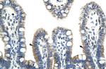 BTBD6 Polyclonal Antibody