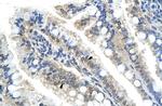 NAC1 Antibody in Immunohistochemistry (IHC)