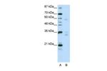 ZNF440 Antibody in Western Blot (WB)