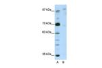 GLIS3 Antibody in Western Blot (WB)