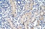 Aprataxin Polyclonal Antibody