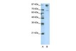 HKR1 Antibody in Western Blot (WB)