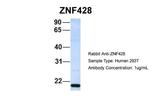 ZNF428 Antibody in Western Blot (WB)