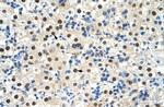 ZNF326 Antibody in Immunohistochemistry (IHC)