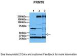 PRMT8 Polyclonal Antibody