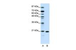 RPL9 Polyclonal Antibody