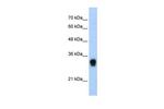 RPL8 Antibody in Western Blot (WB)