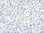 SF3B1 Polyclonal Antibody