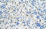 SF3B1 Antibody in Immunohistochemistry (Paraffin) (IHC (P))