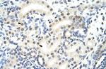 SNRNP70 Antibody in Immunohistochemistry (Paraffin) (IHC (P))
