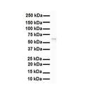SNRNP70 Antibody in Western Blot (WB)