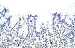 hnRNP A1L2 Polyclonal Antibody
