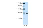 hnRNP A1L2 Antibody in Western Blot (WB)