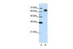 FXR1 Polyclonal Antibody