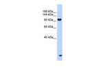TNRC6B Polyclonal Antibody