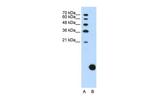 RPS29 Antibody in Western Blot (WB)