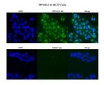 PPP1R10 Polyclonal Antibody