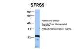 SRSF9 Antibody in Western Blot (WB)