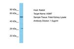 ASMT Polyclonal Antibody
