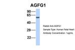 AGFG1 Antibody in Western Blot (WB)