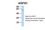 AGFG1 Polyclonal Antibody