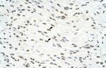 ILF3 Polyclonal Antibody