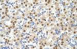 ILF3 Polyclonal Antibody