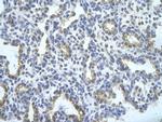 SFRS10 Polyclonal Antibody