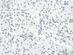 SNRPA Polyclonal Antibody