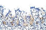TROVE2 Polyclonal Antibody
