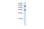 RRP9 Polyclonal Antibody
