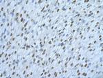 hnRNP DL Antibody in Immunohistochemistry (Paraffin) (IHC (P))