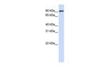 CTAGE5 Polyclonal Antibody