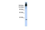 PRP8 Polyclonal Antibody