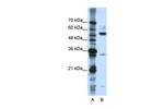 KHDRBS3 Antibody in Western Blot (WB)
