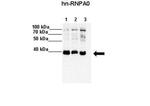 HNRNPA0 Antibody in Western Blot (WB)