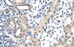 SNRPD1 Polyclonal Antibody