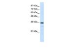 SNRNP35 Antibody in Western Blot (WB)