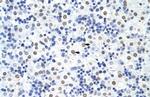 hnRNP UL1 Antibody in Immunohistochemistry (Paraffin) (IHC (P))