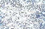 hnRNP H3 Antibody in Immunohistochemistry (Paraffin) (IHC (P))