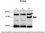 RCAN3 Antibody in Western Blot (WB)