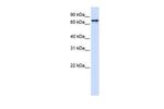 SRP68 Polyclonal Antibody