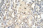 PUF60 Polyclonal Antibody